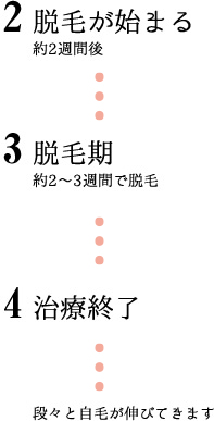 脱毛が始まる　脱毛期　治療終了